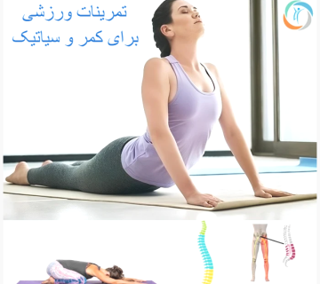 تمرینات ورزشی برای کمر و سیاتیک