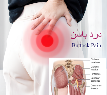 درد باسن