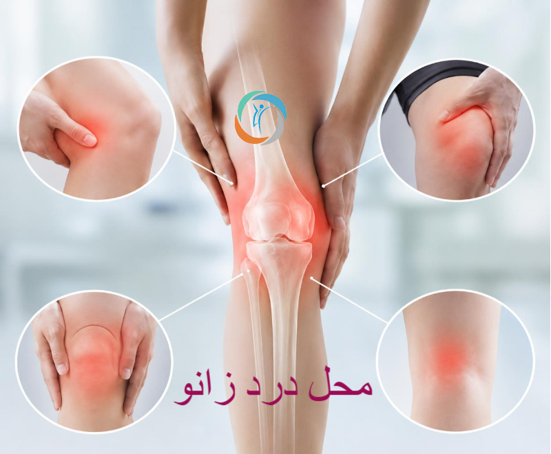 محل درد زانو
