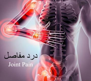 درد مفاصل