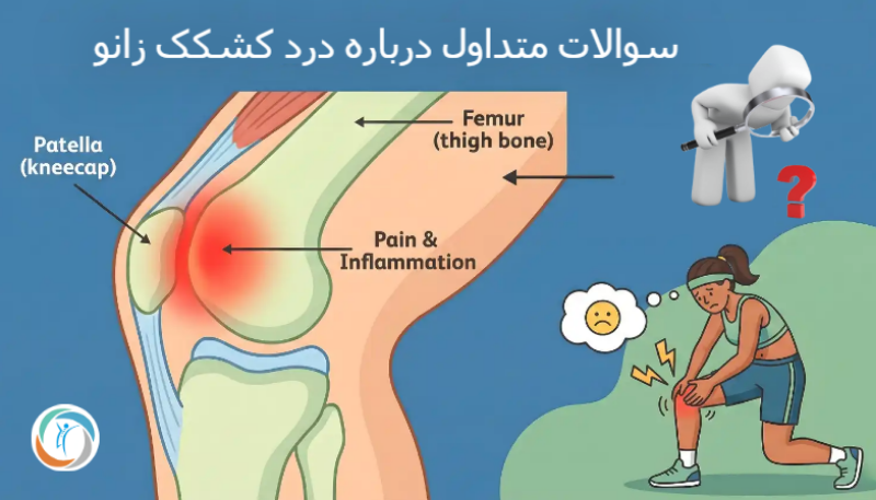 سوالات متداول درباره درد کشکک زانو