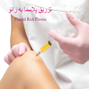 نظرات بیماران کلینیک دکتر نوری/درمان آرتروز