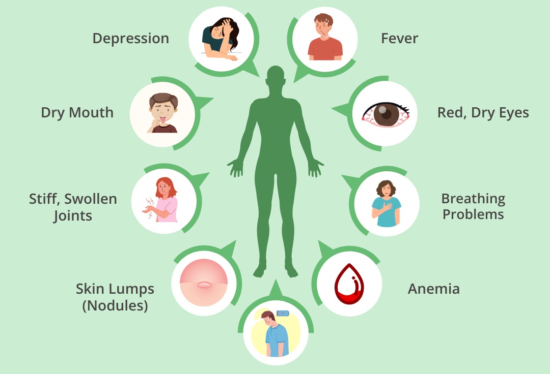 علائم آرتریت روماتوئید