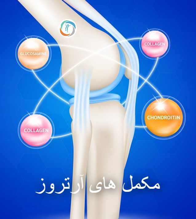 مکمل‌های آرتروز