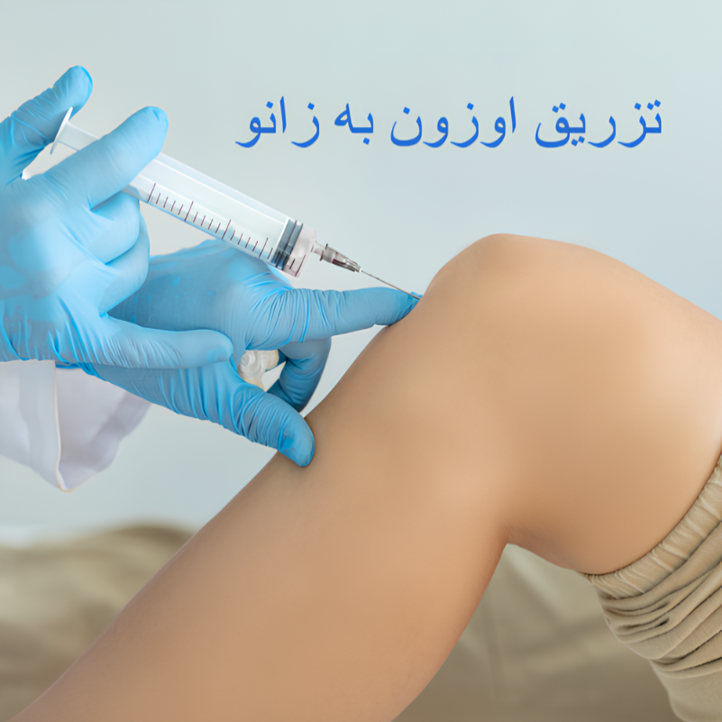 متخصص زانو تهران