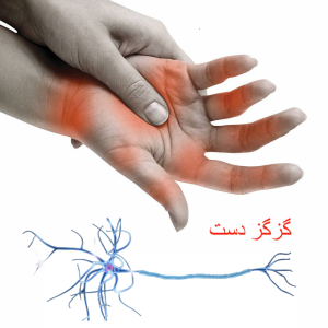 ورزش های دست / گزگز دست