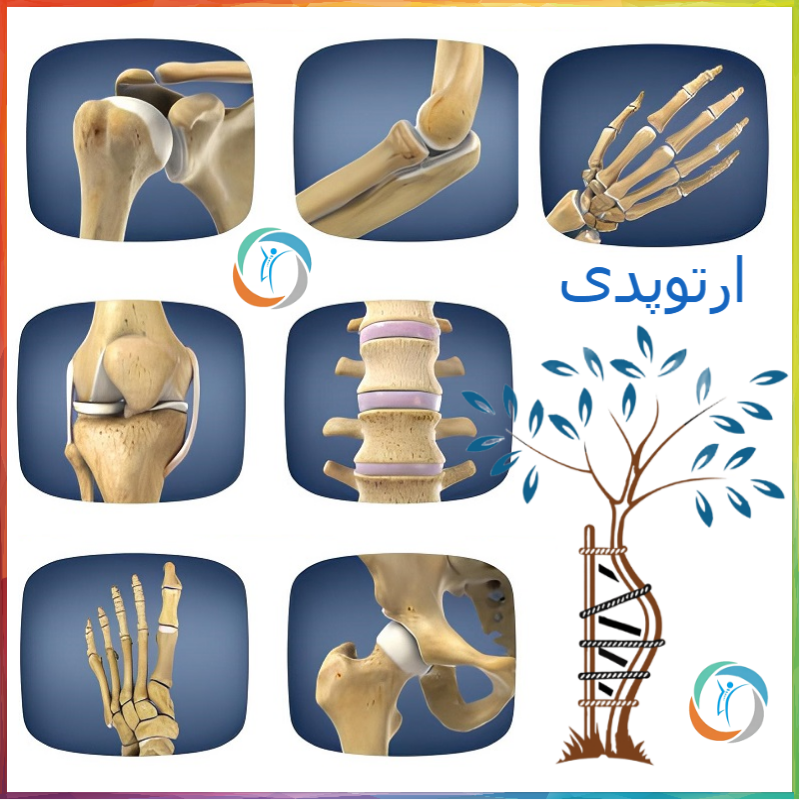 رشته ارتوپدی