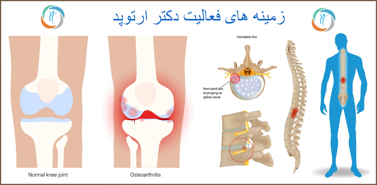 زمینه‌ های فعالیت دکتر ارتوپد