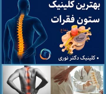 بهترین کلینیک ستون فقرات تهران