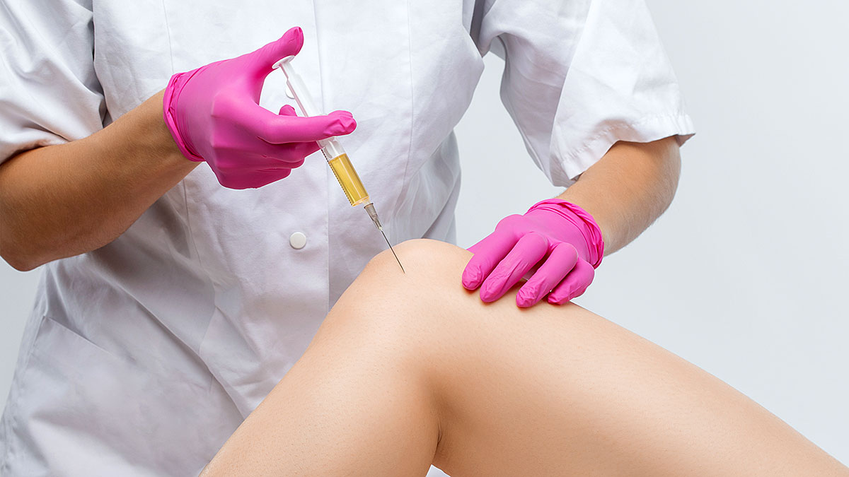 تزریق پی آر پی