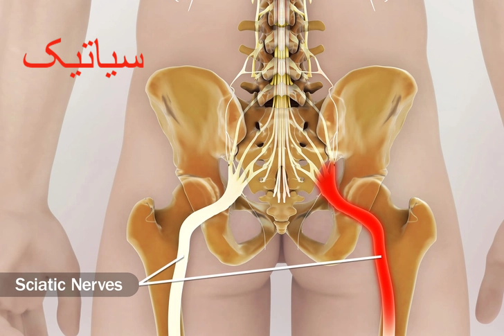 متخصص ستون فقرات