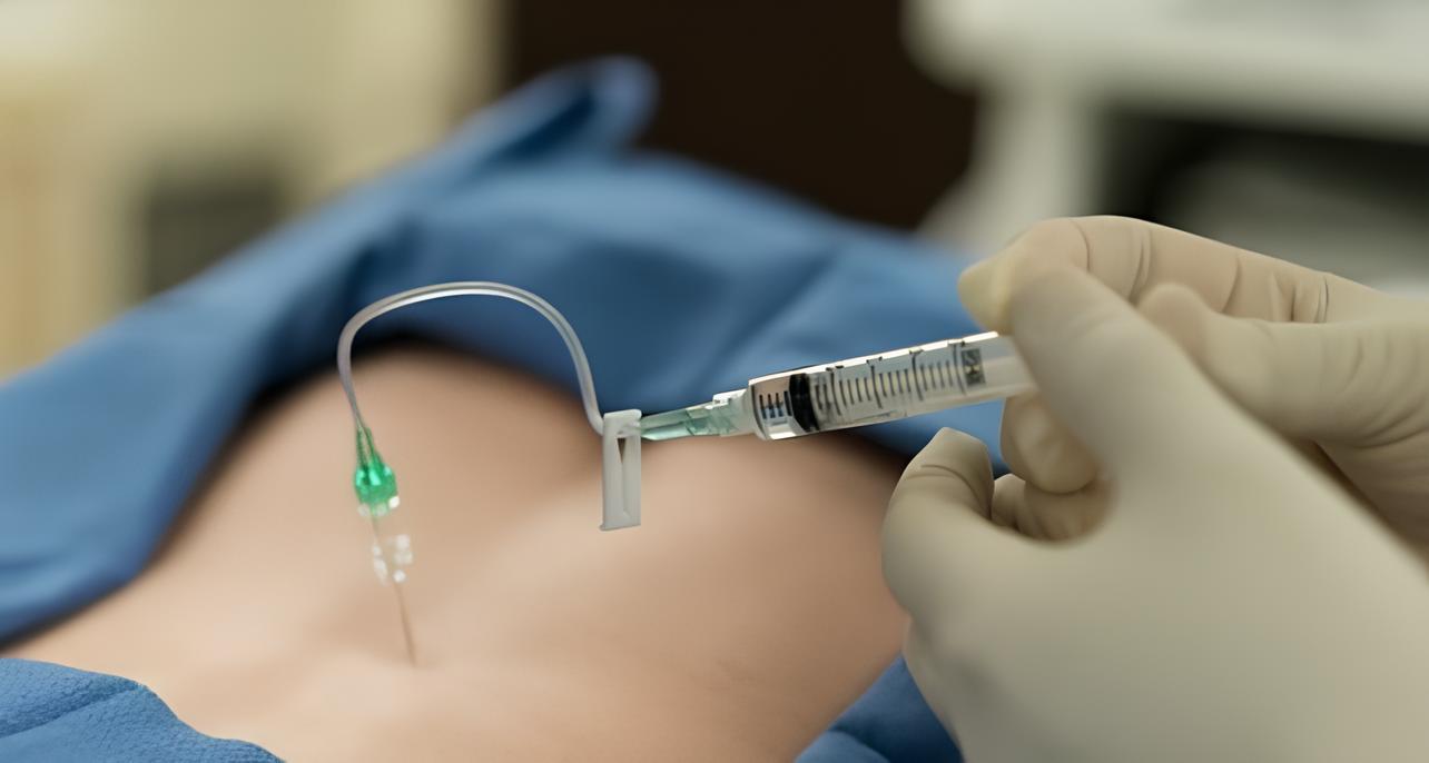 تزریق ستون فقرات