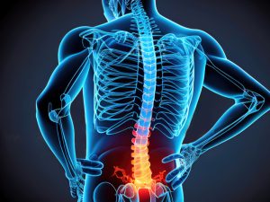 کمردرد ناگهانی