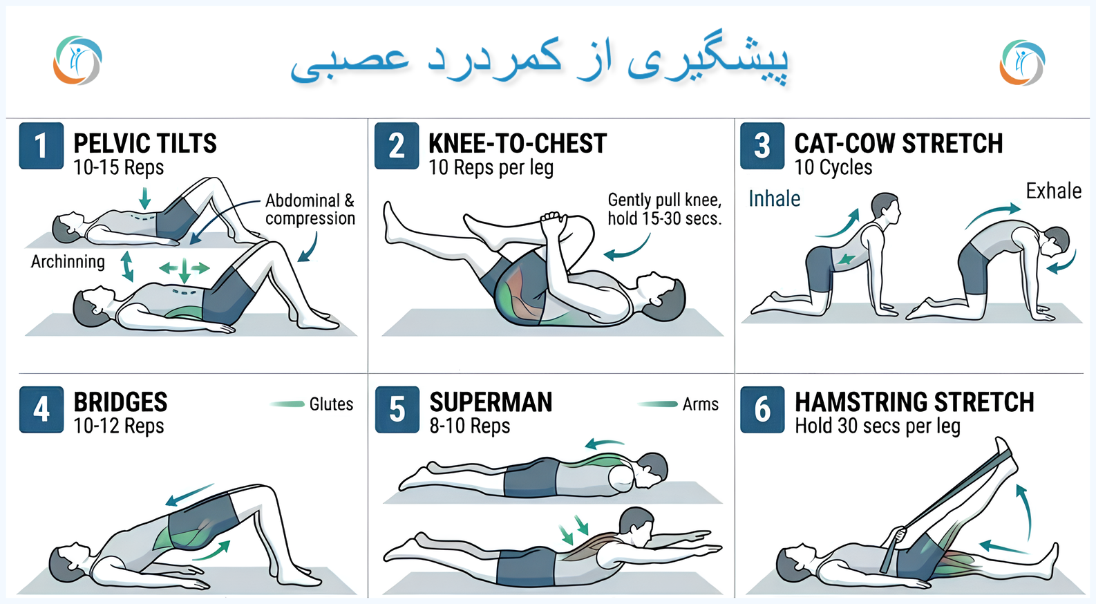 پیشگیری از کمردرد عصبی