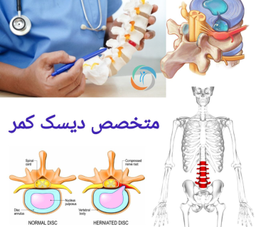 متخصص دیسک کمر
