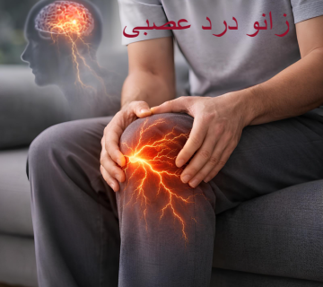 زانو درد عصبی