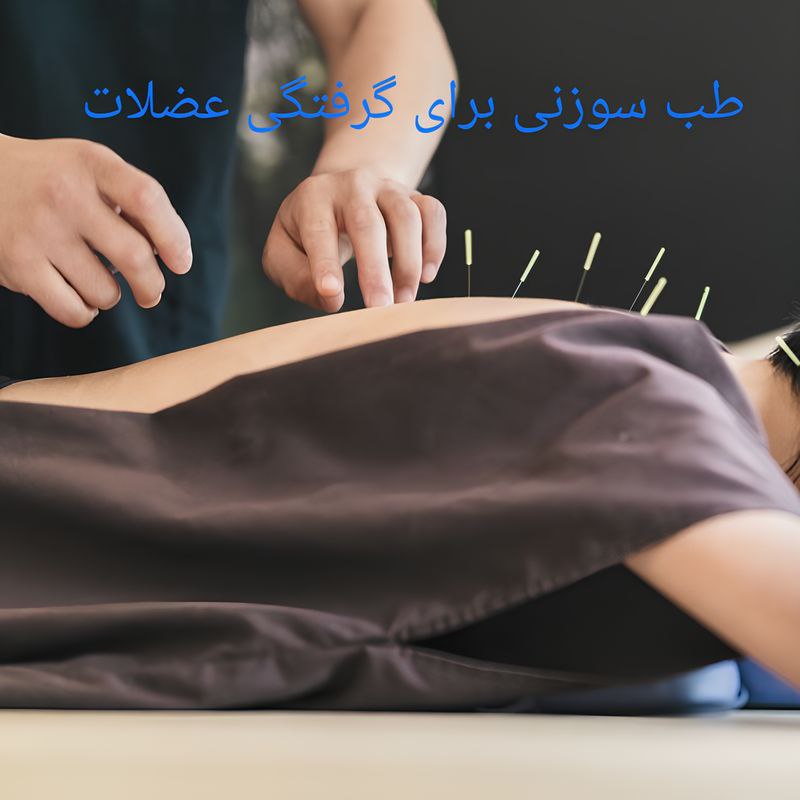طب سوزنی برای گرفتگی عضلات