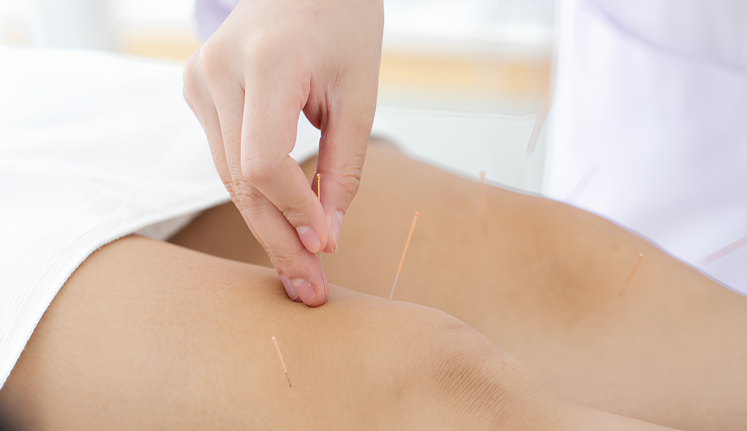 طب سوزنی برای گرفتگی عضلات