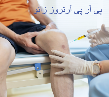 پی آر پی آرتروز زانو