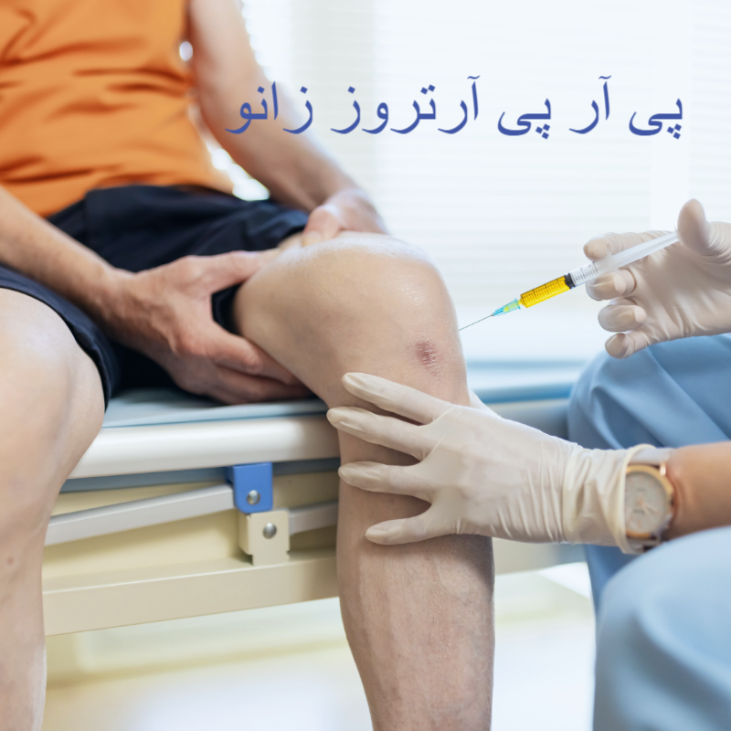 پی آر پی آرتروز زانو