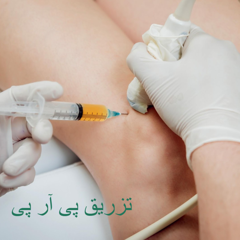 تزریق پی آر پی