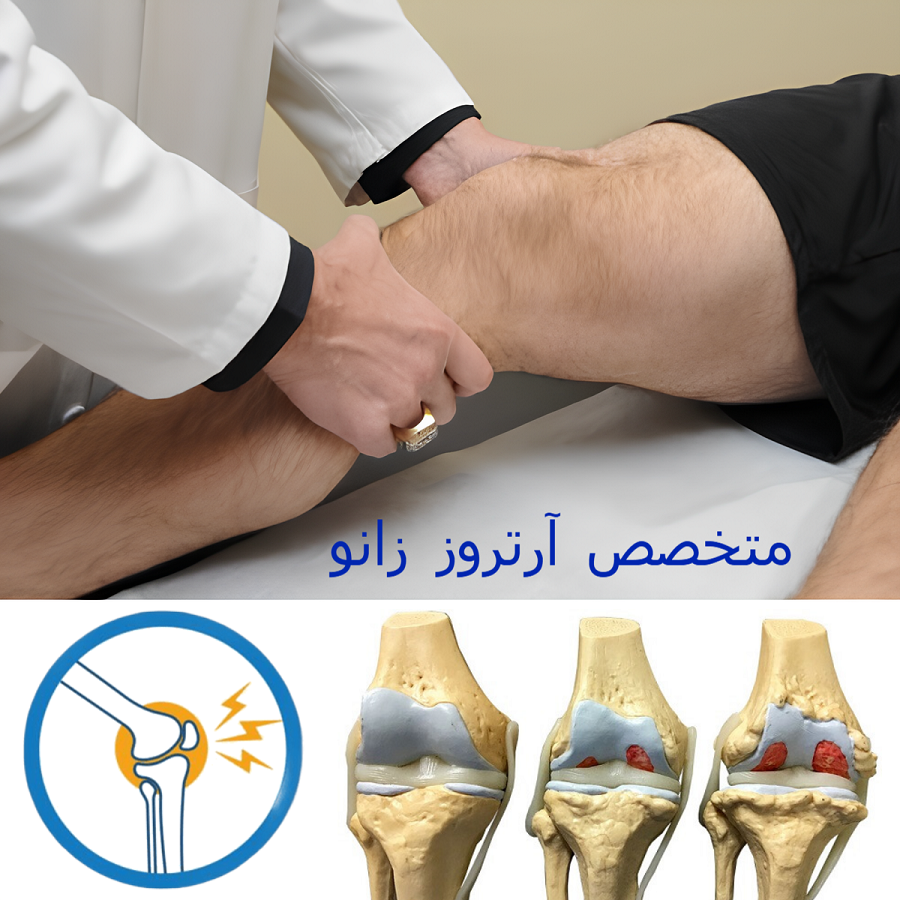 بهترین متخصص آرتروز زانو