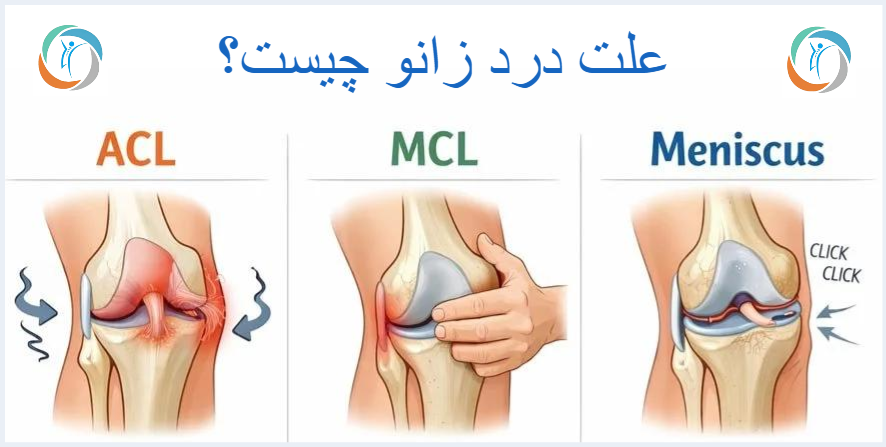 علت درد زانو چیست؟