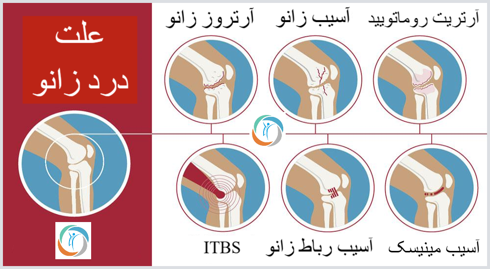 علت درد زانو