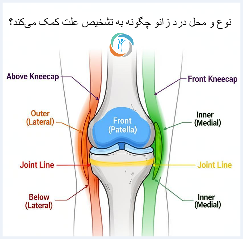 نوع و محل درد زانو چگونه به تشخیص علت کمک می‌کند؟