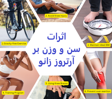 تاثیر سن و وزن بر آرتروز زانو