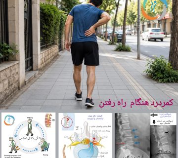 کمردرد هنگام راه رفتن