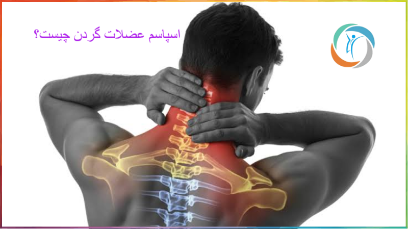 اسپاسم و گرفتگی گردن چیست؟