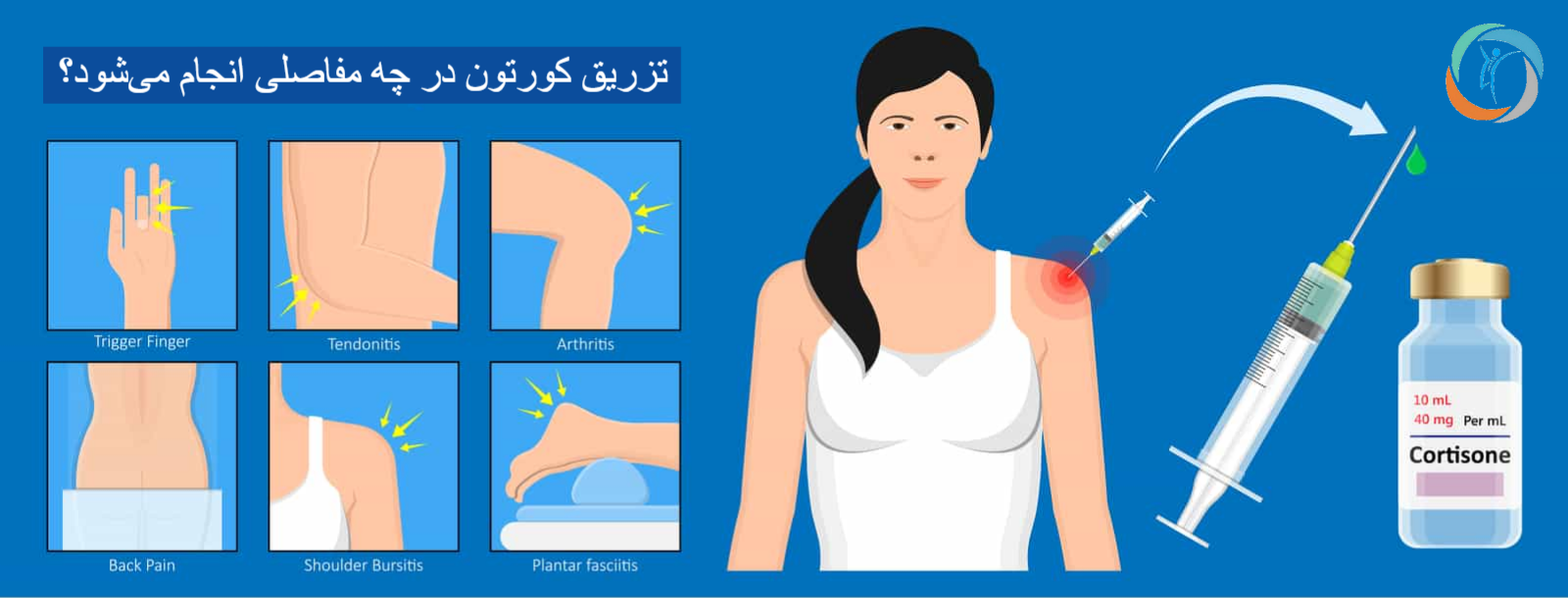 تزریق کورتون در چه مفاصلی انجام می‌شود؟