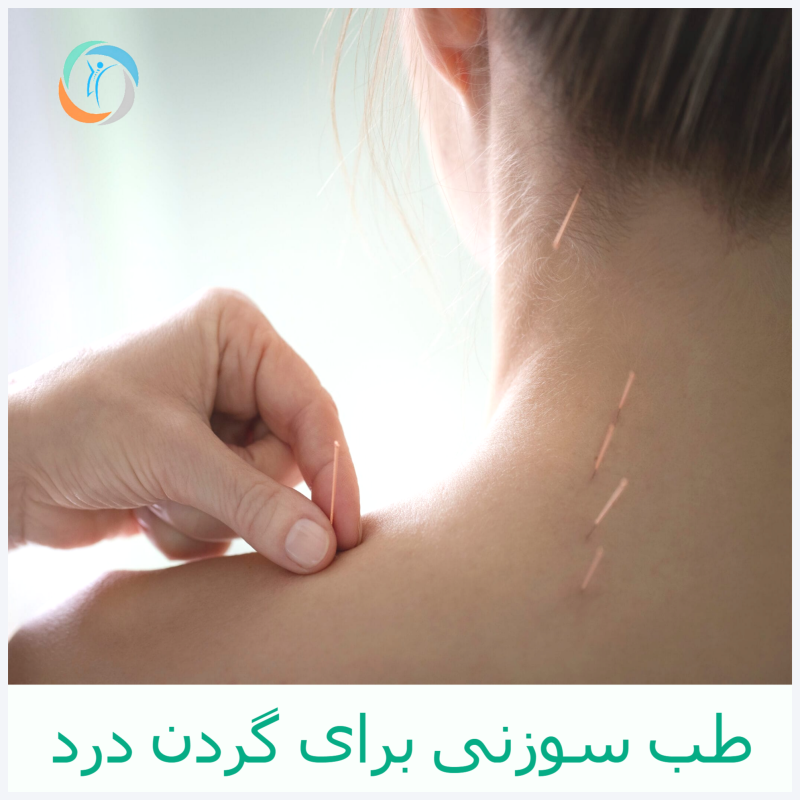 طب سوزنی برای گردن درد