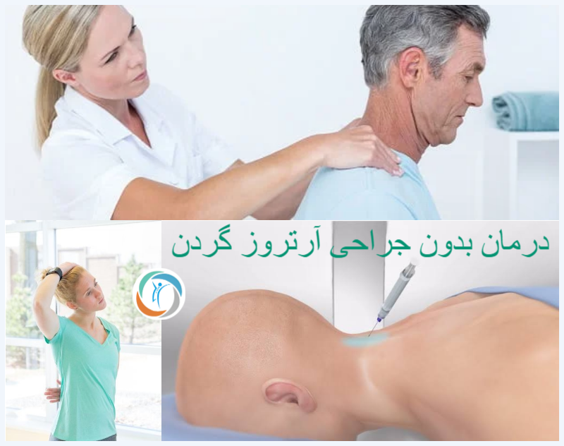 درمان بدون جراحی آرتروز گردن