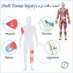 آسیب بافت نرم چیست؟