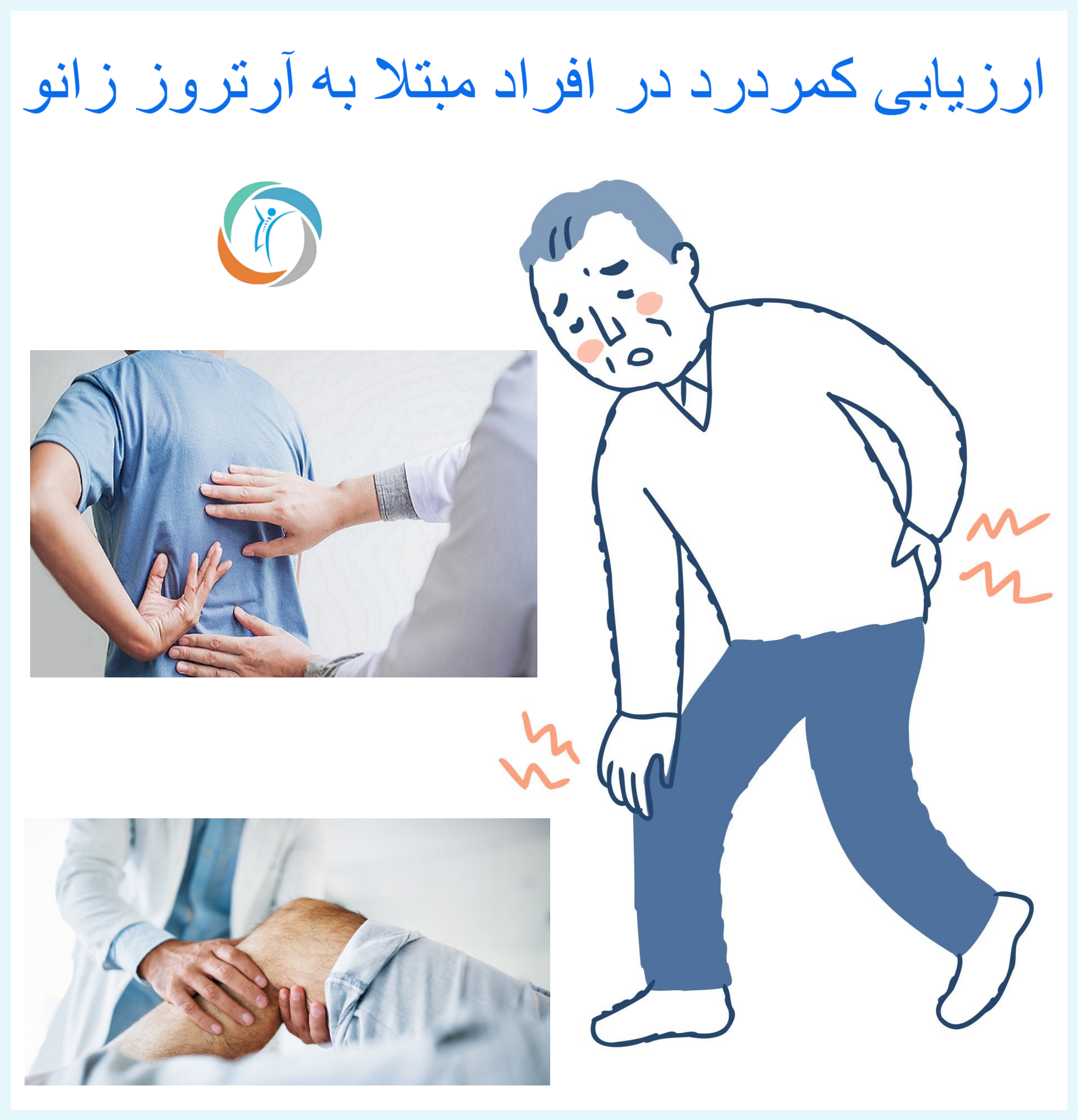 ارزیابی کمر درد در افراد مبتلا به آرتروز زانو