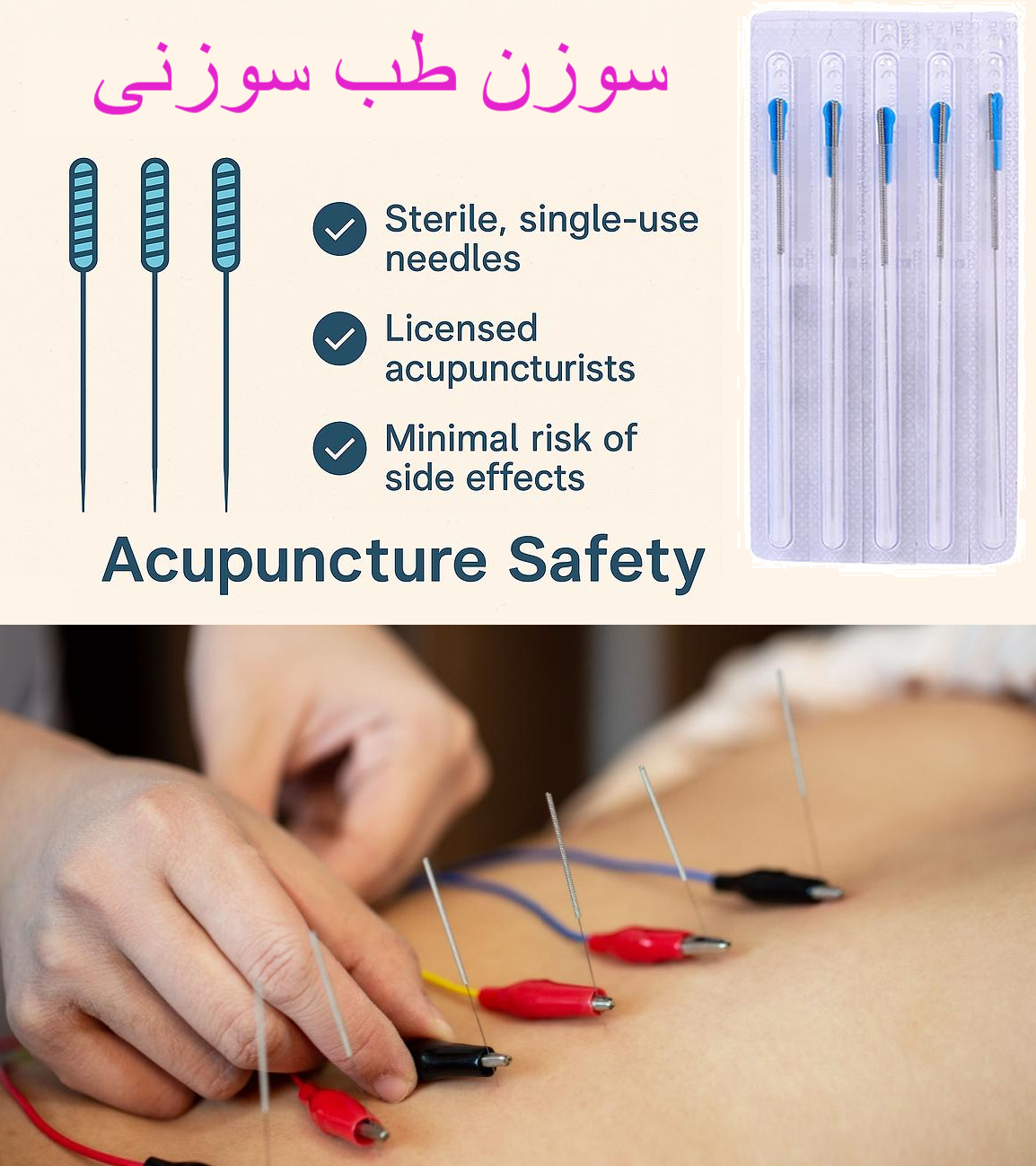 سوزن‌ها و تجهیزات مورد استفاده در کلینیک طب سوزنی
